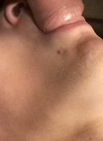 180186