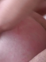 7081271