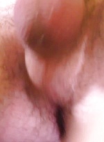 7087236