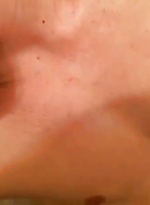 7091382